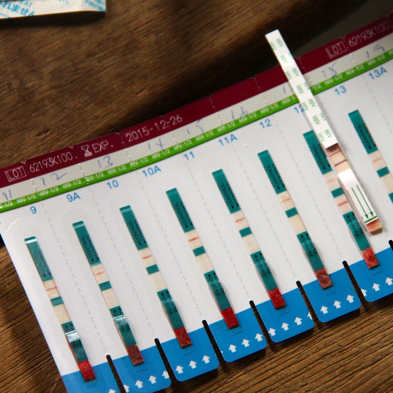 HIV screening, treatment & counselling - testing strips